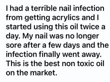 Load image into Gallery viewer, Anti- Fungus Oil