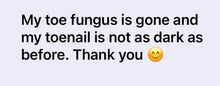Load image into Gallery viewer, Anti- Fungus Oil